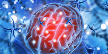 Рассеянный склероз: многоликость неврологического заболевания