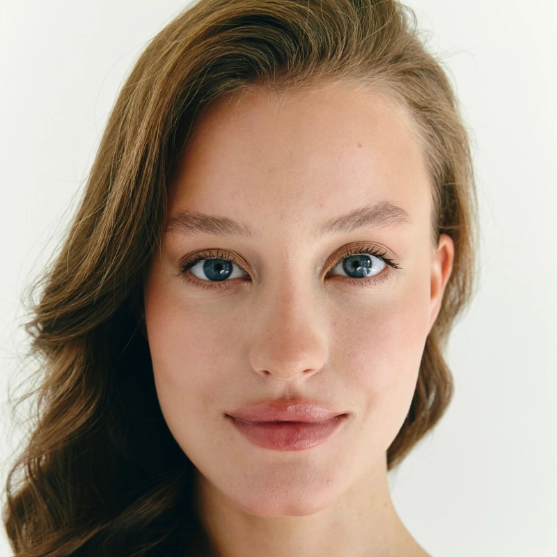 Блефаропластика верхних век: как вернуть взгляду молодость и открытость