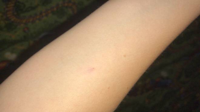 Через сколько дней после Манту можно делать прививки – какое время должно пройти?