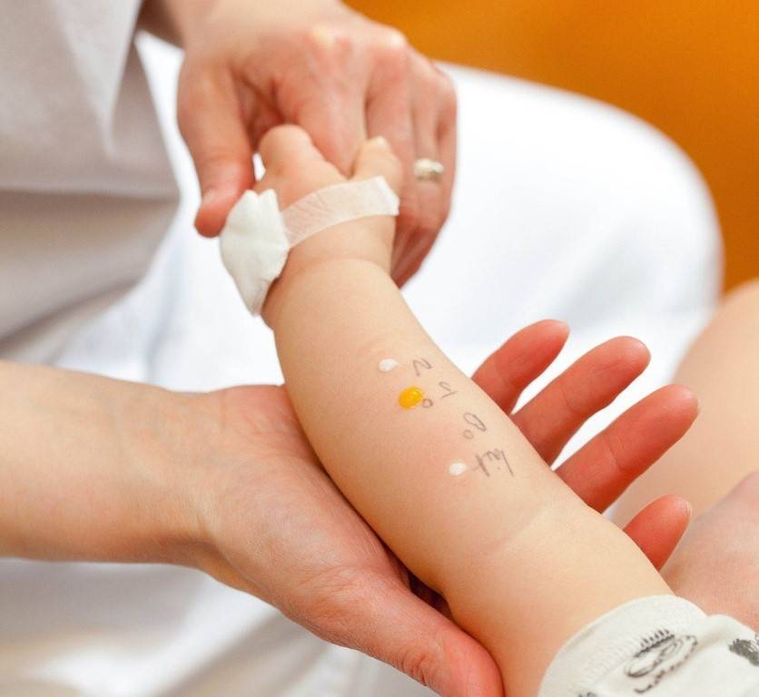 Аллергия на молоко у ребенка: симптомы, фото непереносимости белка у грудничка