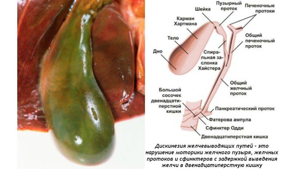 Дискинезия кишечника у детей: причины возникновения, симптомы и лечение