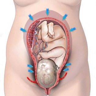 Эмболия околоплодными водами: что это такое, какие причины возникновения, как лечить?
