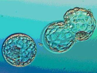 Запор после переноса эмбрионов при ЭКО: почему бывает и что делать?