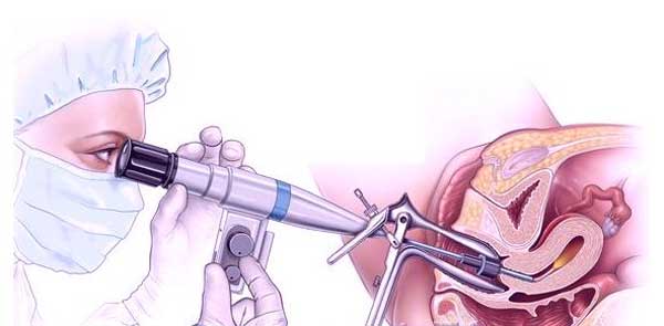 Удаление маточных труб перед ЭКО: возможна ли процедура после этой операции?