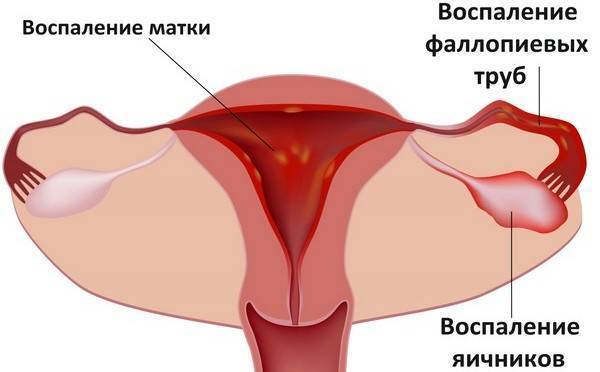 Во время месячных болит влагалище: причины неприятных ощущений при менструации, устранение боли