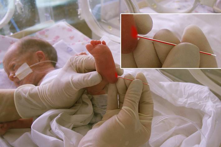 Неонатальный скрининг новорожденных в роддоме на наследственные заболевания (анализ крови из пятки)