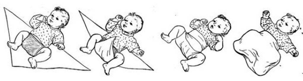 Дисплазия тазобедренных суставов у детей до года (новорожденных): лечение и признаки с фото