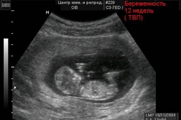 УЗИ на 34 неделе беременности: показатели нормы у плода и будущей матери