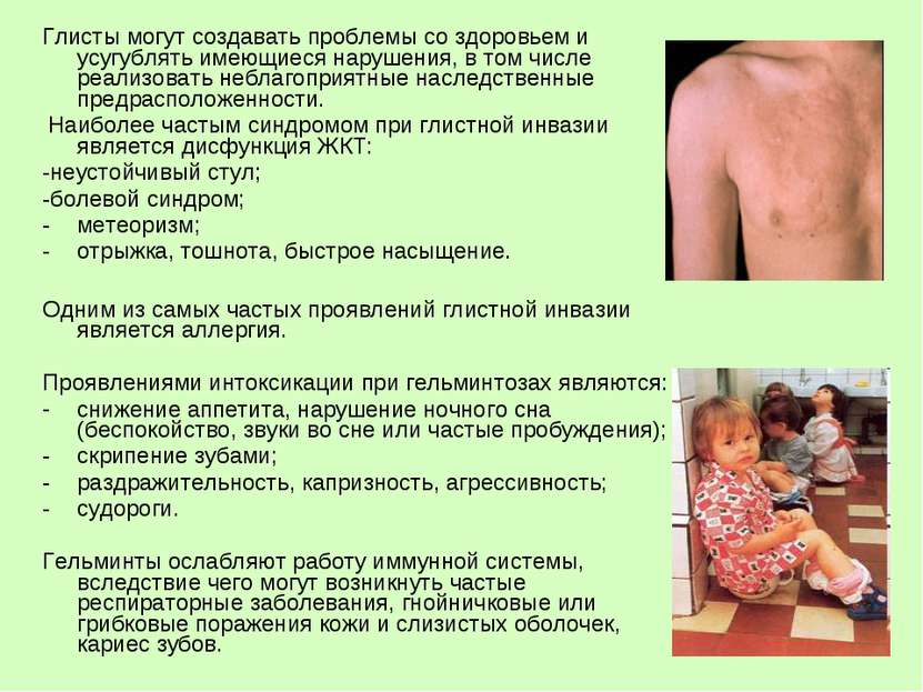 Глисты у детей: симптомы и лечение гельминтоза - как понять, есть ли паразиты в организме?