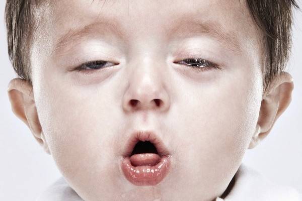 Ларингит у детей: симптомы и лечение в домашних условиях (список препаратов и антибиотиков)