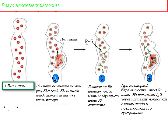 Иммуноглобулин при беременности при отрицательном резус-факторе, последствия введения укола