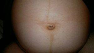 Почему при беременности пупок может вылезать, темнеть и становиться горячим, что делать?
