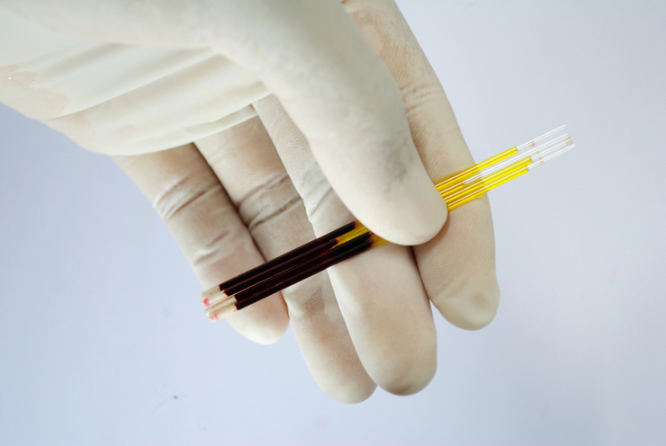 Гематокрит понижен при беременности: причины, нормы в разных триместрах