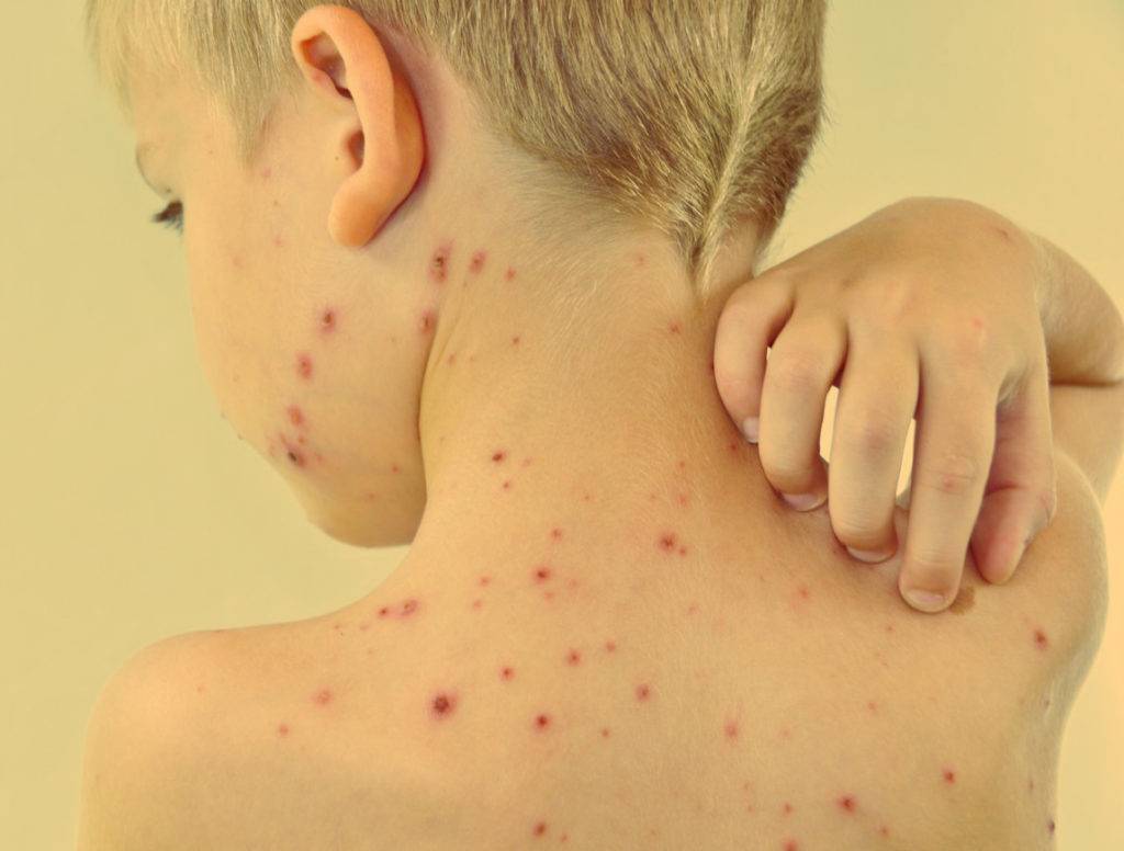 Шершавые пятна на теле у ребенка (на коже ног и рук, на спине и лице): фото