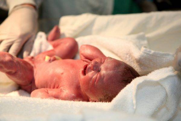 Шкала Апгар новорожденных в таблице: расшифровка баллов и нормы