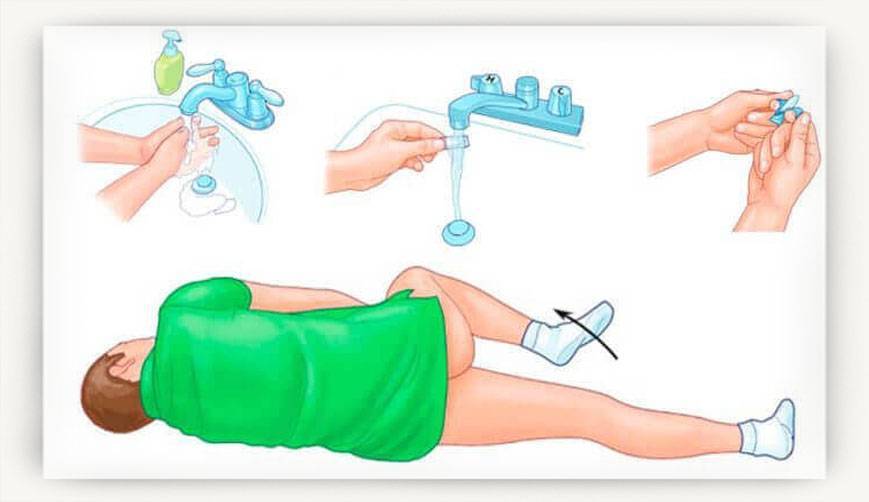 Свечи от температуры для детей от 1 года: жаропонижающие суппозитории