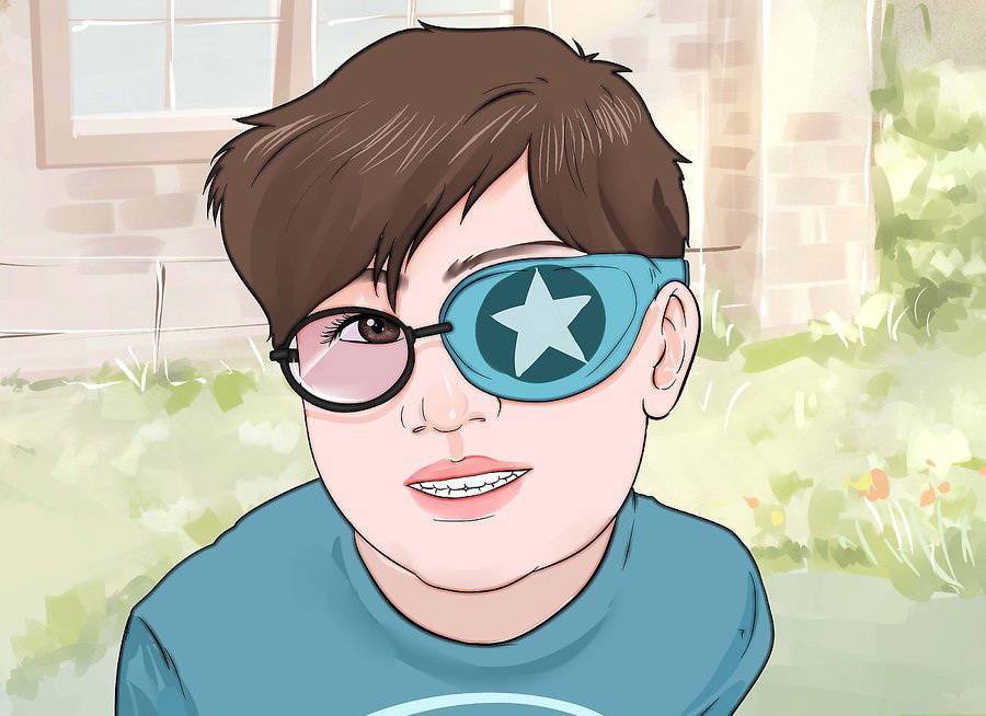 Склеропластика глаз у детей - что это такое, какие есть "за" и "против" для операции?