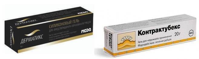 Кесарево сечение при тазовом предлежании: когда делают, как проходит, какие плюсы и минусы операции?