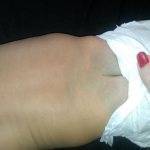 Монгольское пятно у новорожденных: причины и значение