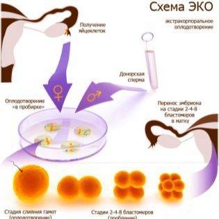 Как зачать девочку 100 процентов по овуляции: календарь расчета беременности