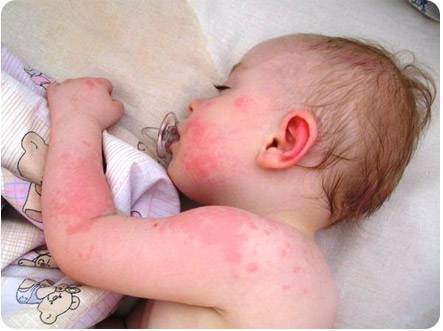 Успокоительное для кормящих мам: Глицин при грудном вскармливании, Пустырник