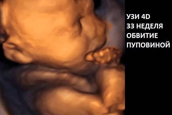 УЗИ на 34 неделе беременности: показатели нормы у плода и будущей матери