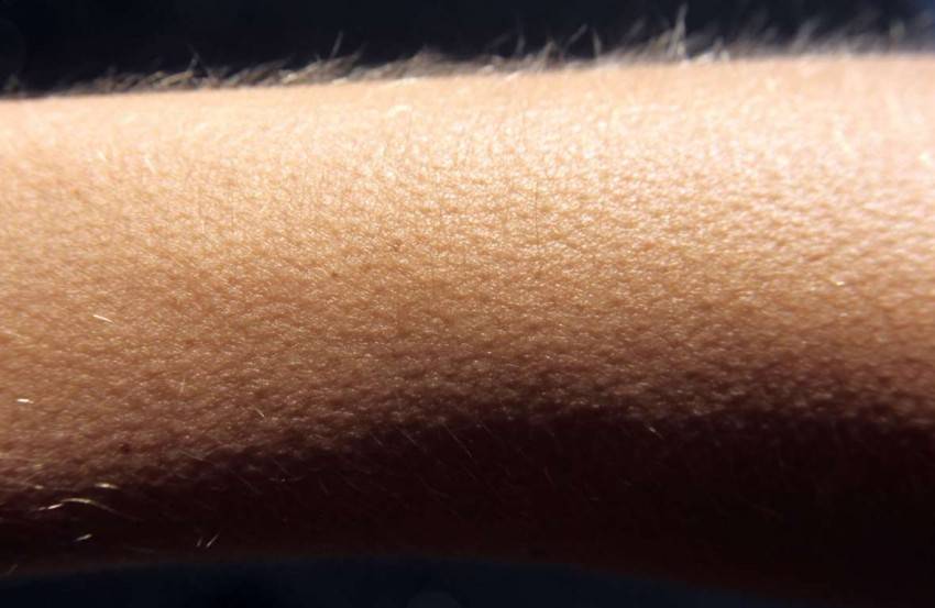 Гусиная кожа у ребенка: причины сыпи на животе, ногах, локтях, лице и лечение