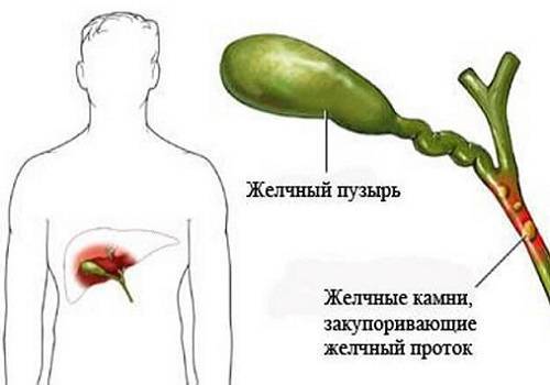 Реактивные изменения поджелудочной железы у ребенка: что это такое и как проявляется?