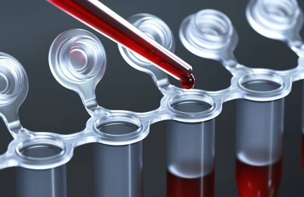 Неонатальный скрининг новорожденных в роддоме на наследственные заболевания (анализ крови из пятки)