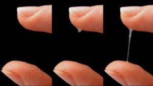 Выделения у девочек от 3 лет: причины и лечение в разном возрасте