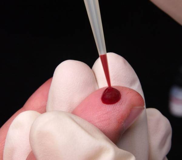 Анализы на глисты у детей: исследование крови, кала и другие методы выявления гельминтов