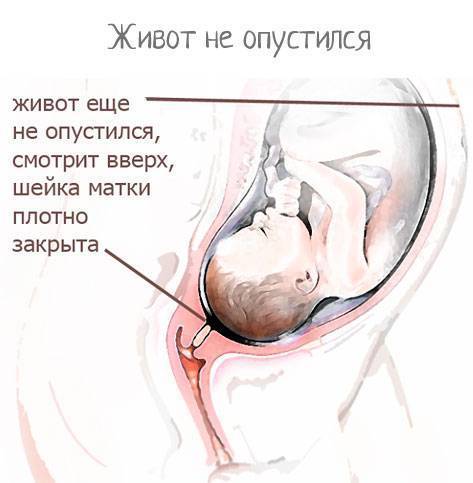 Как понять, что опустился живот перед родами: на какой неделе происходит опущение, когда рожать?
