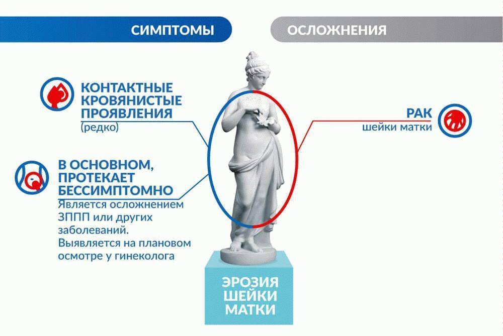 Месячные со слизью: причины выделений при менструации, похожих на сопли прозрачного цвета