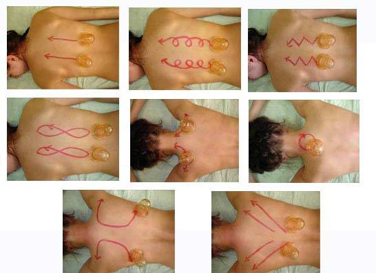 Массаж при кашле и бронхите у детей для отхождения мокроты: дренажный и вибрационный