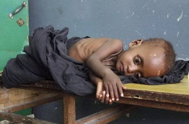 Гипотрофия у детей раннего возраста: 1, 2 и 3 степени (лечение, профилактика)