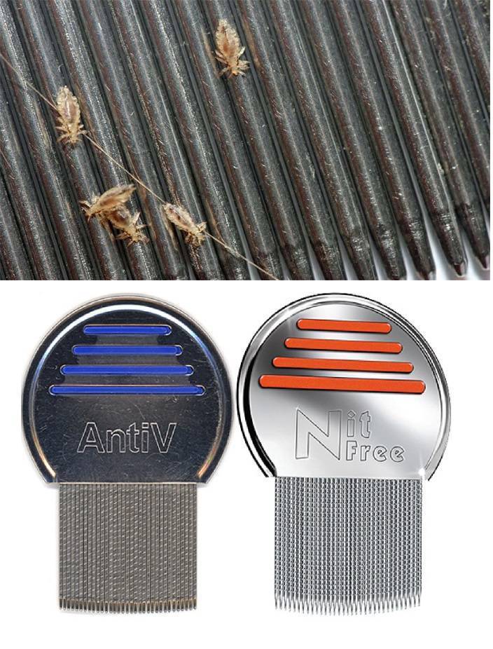 Как вывести вшей в волосах у ребенка: симптомы педикулеза с фото и лечение в домашних условиях