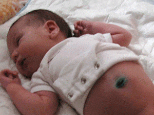 Обработка пупочной ранки у новорожденного ребенка в домашних условиях (пупка)