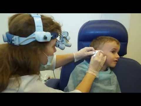 Удаление аденоидов у детей под общим и местным наркозом - как проходит операция (видео)?