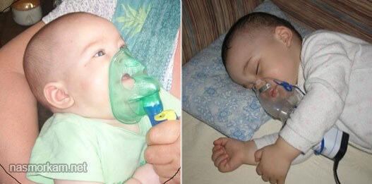 Ингаляции с физраствором в небулайзере детям при кашле и насморке: инструкция и дозировка