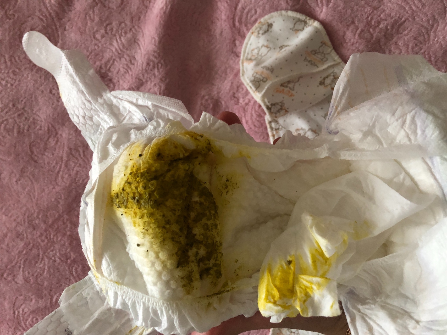 Слизь и белые комочки в кале у грудничка на искусственном вскармливании