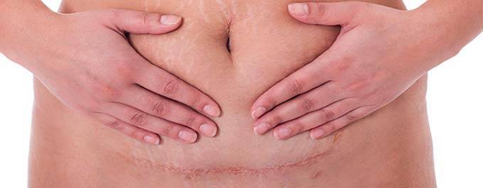 Давление перед родами: почему повышается или понижается АД, что делать?