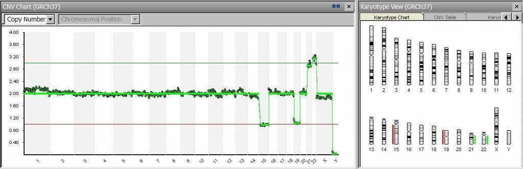 ПГД эмбриона: для чего проводится при ЭКО, как проходит генетический анализ?