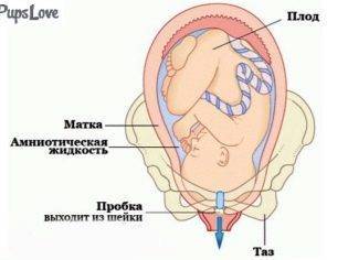 Бежевые выделения при беременности на ранних сроках светлого, желтого или коричневого оттенка