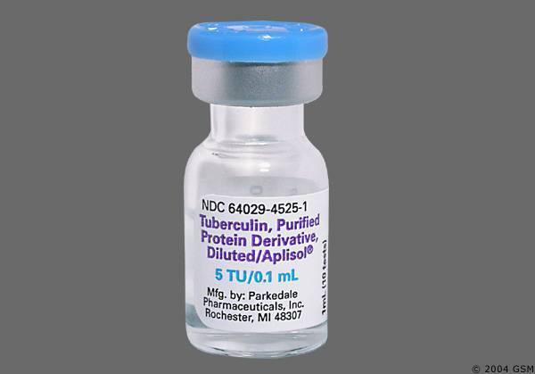 Реакция Манту у детей: норма размеров по возрасту в 1-3 года с фото