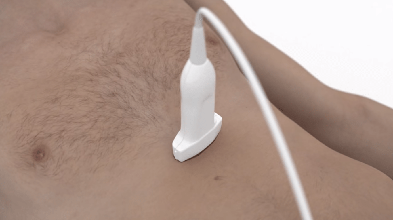 УЗИ селезенки детей: размеры органа в норме, причины отклонений в разном возрасте