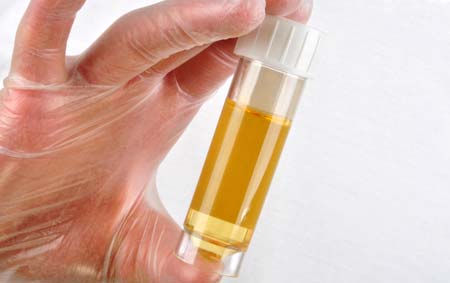 Как правильно сдавать анализ мочи при беременности с ватным тампоном?