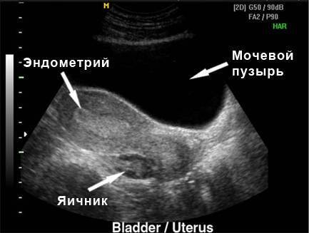 УЗИ на овуляцию: когда делать, как проходит процедура, что можно определить по фото?