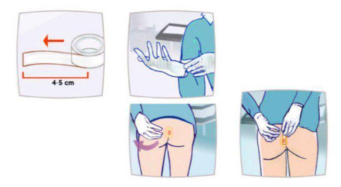 Обзор лекарств от остриц для детей и взрослых: список эффективных таблеток и суспензий