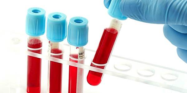 Как узнать на что аллергия у ребенка: способы определения потенциального аллергена