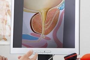 Перекрут гидатиды яичка у детей: симптомы, причины появления у мальчиков, последствия после операции